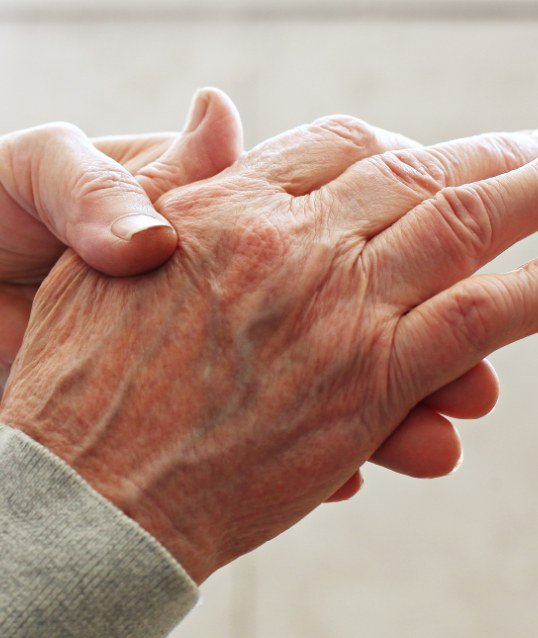 Person with aging hands before hand surgery