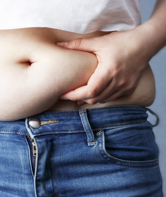 Person grabbing belly fat before tummy tuck procedure