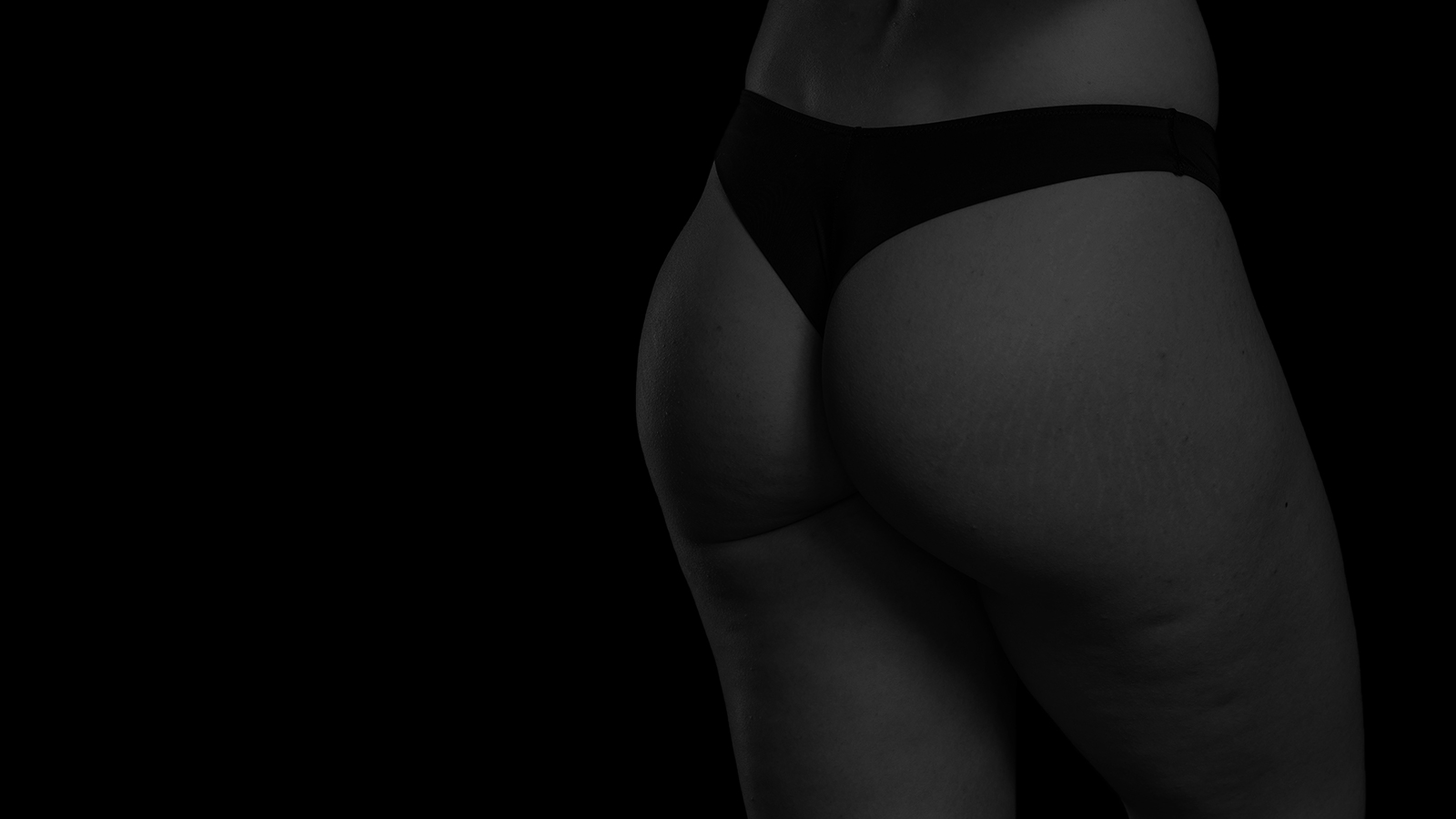 Patient after buttock implant