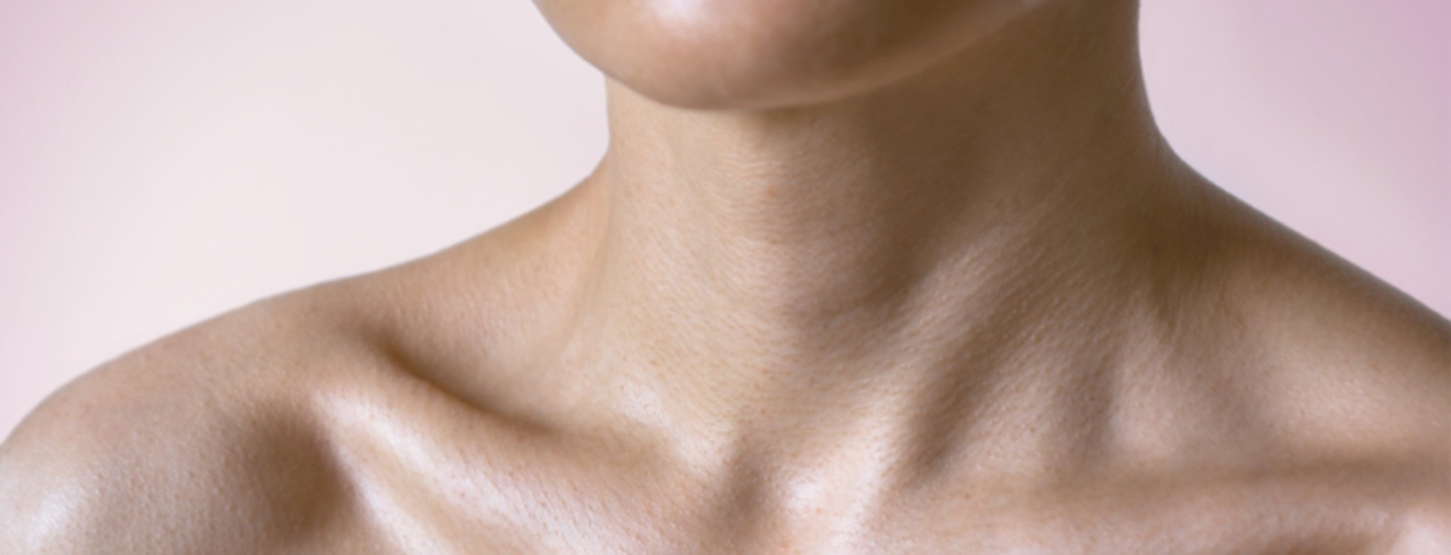 Closeup of neck after filler treatment for neck lines