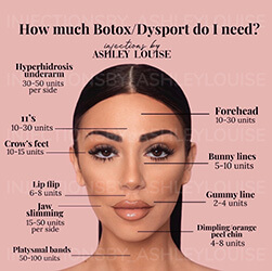 chart of where you can get dysport on face