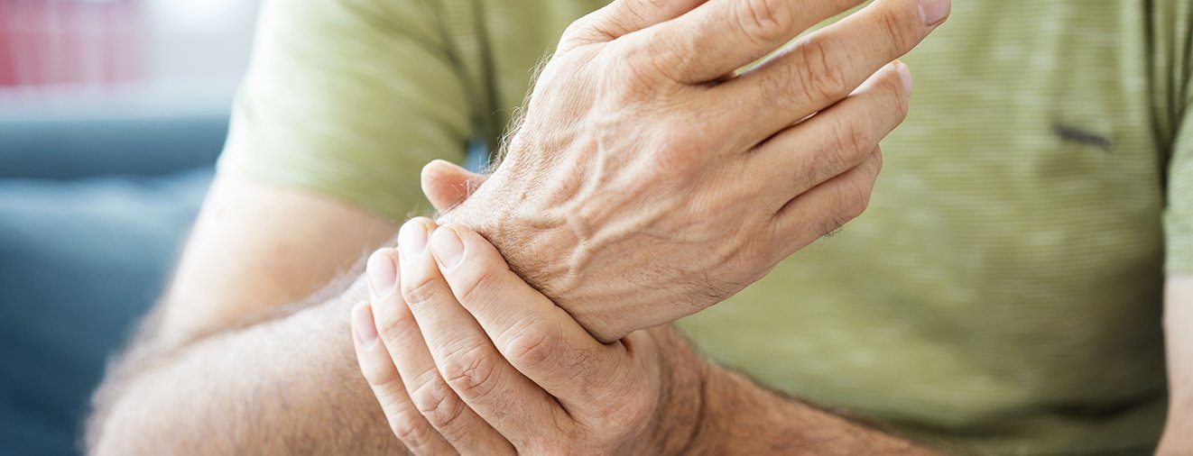 Closeup of hand before hand surgery