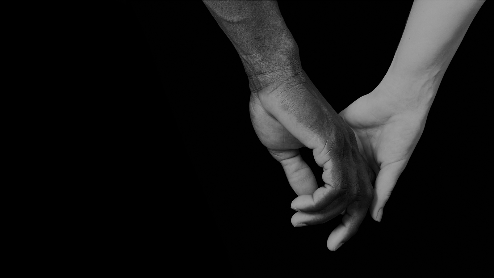 Closeup of patient's hands after hand surgery