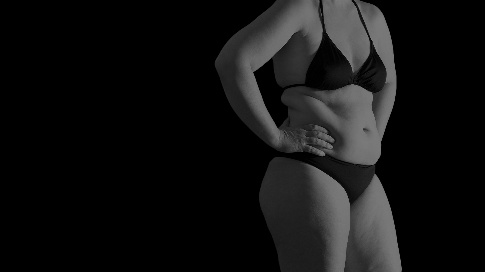Woman with excess fat before liposuction