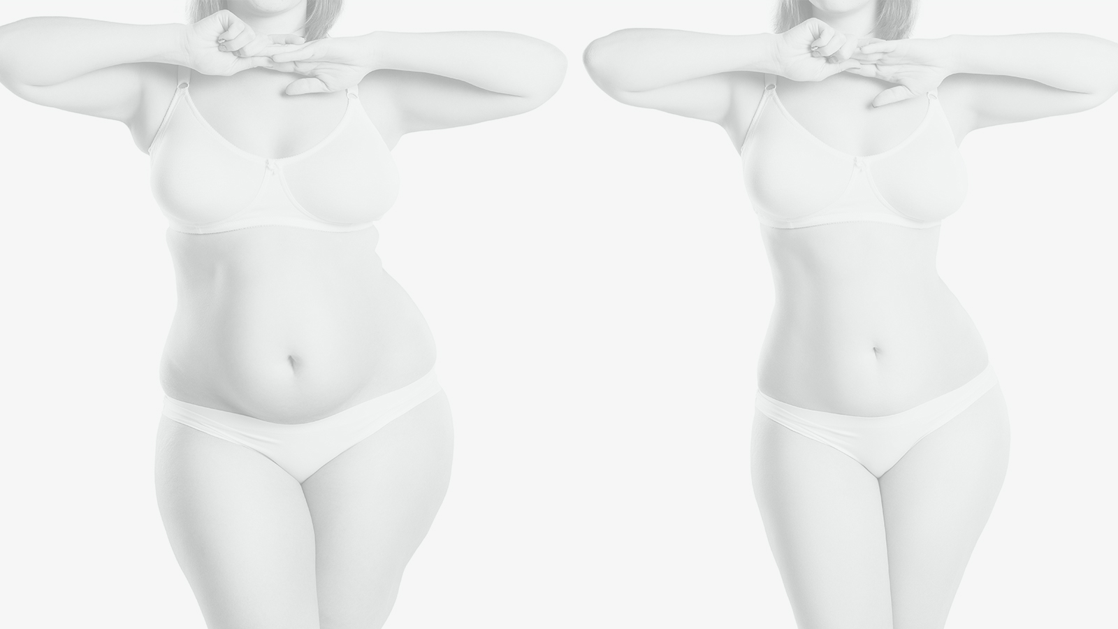 Person before and after tummy tuck